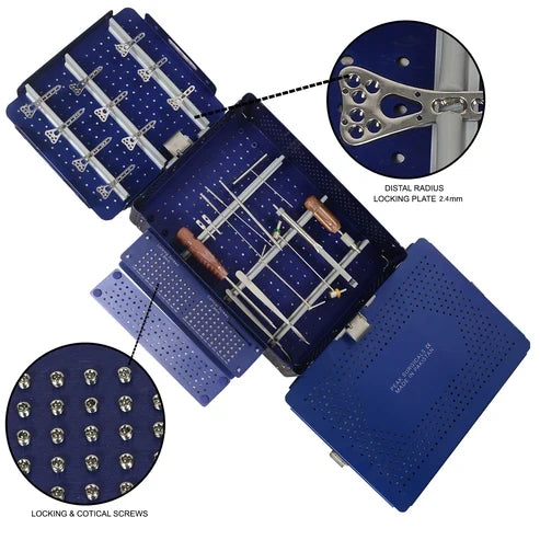 Orthopedic Fragment Sets for Internal Fixation
