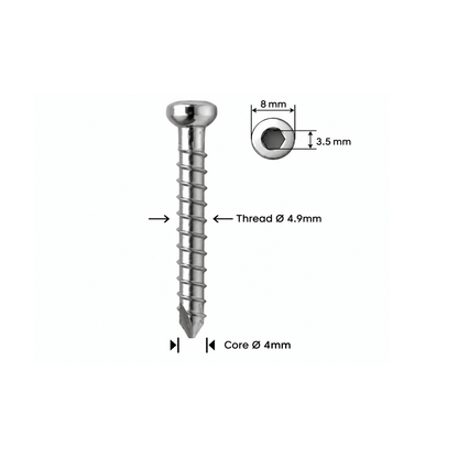 Βίδα ασφάλισης Ø4,9mm