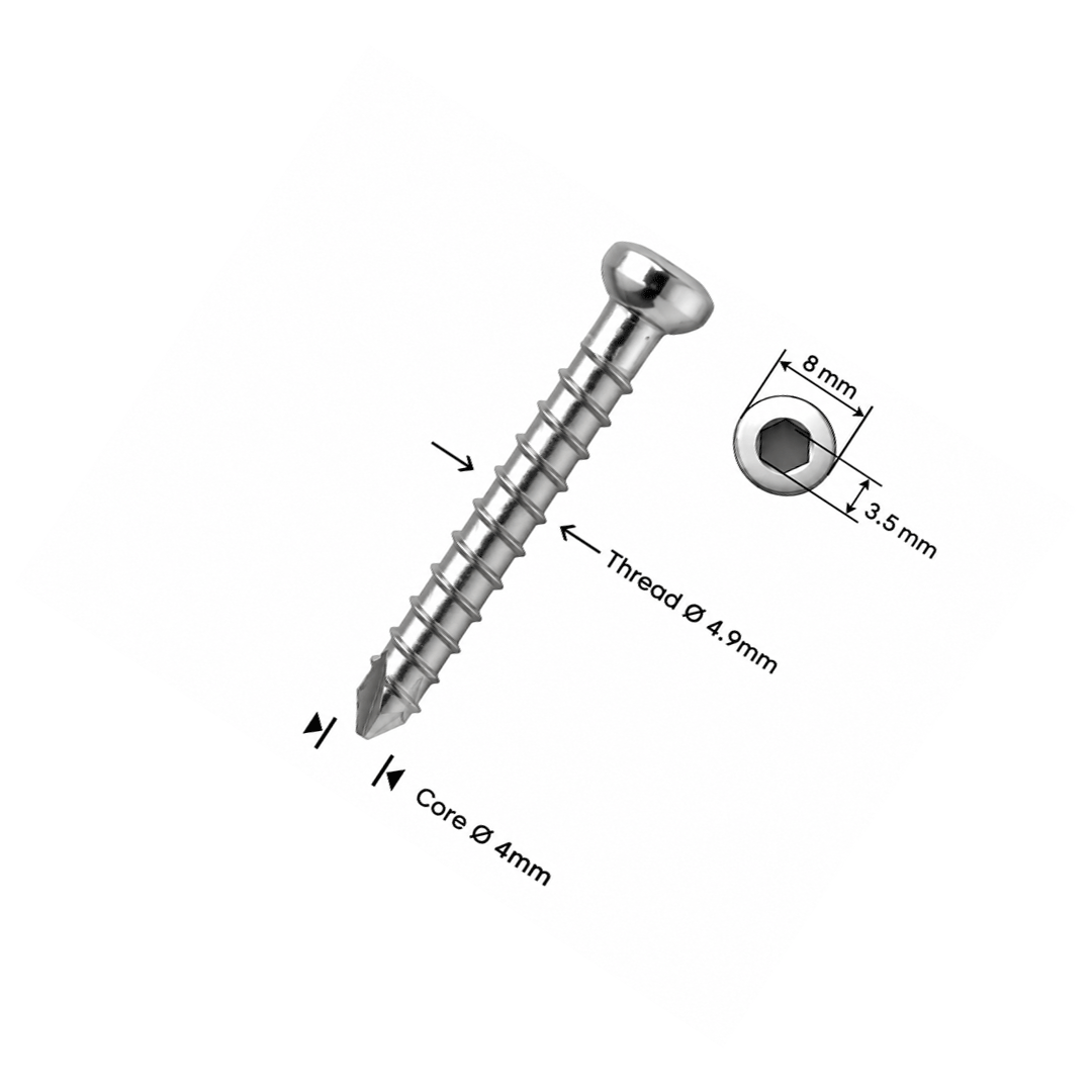 Βίδα ασφάλισης Ø4,9mm