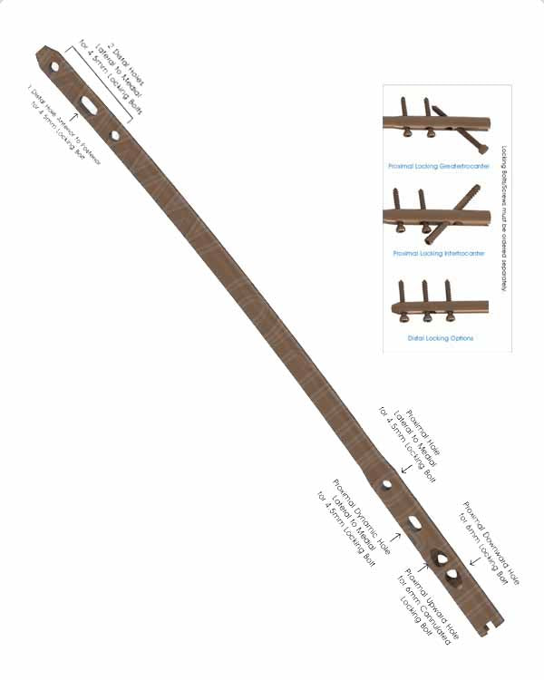 Multi-Fix Femoral Nail Cannulated with Multiple Locking Options