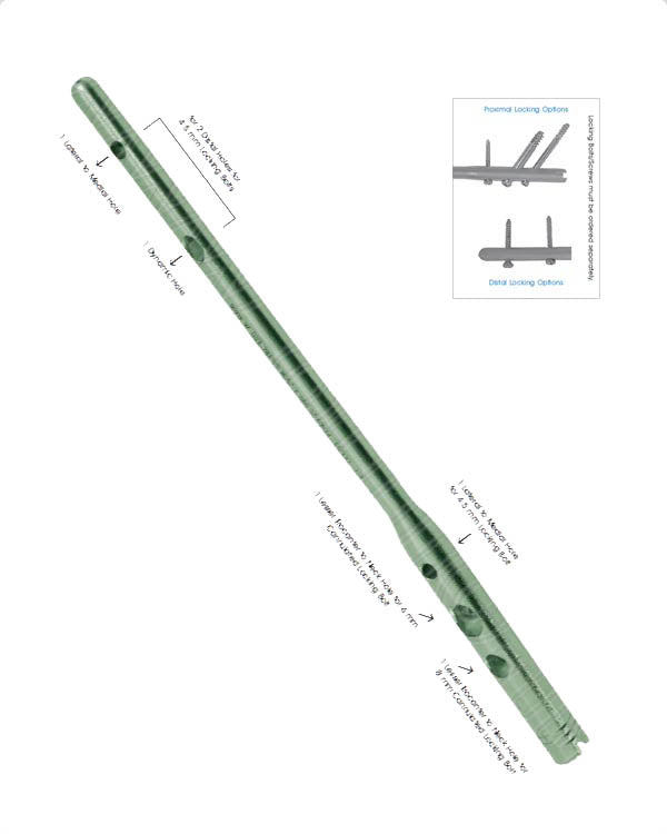 Proximal Femoral Nail (PFN)