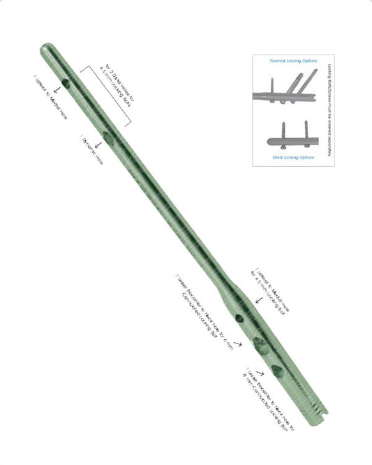 Proximal Femoral Nail (PFN)