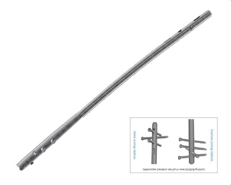 Retrograde Femoral Nail – 180mm to 360mm