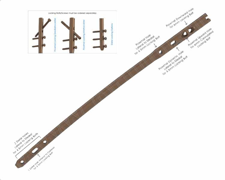 Multi-Fix Femoral Nail - Cannulated, with Multiple Locking Options