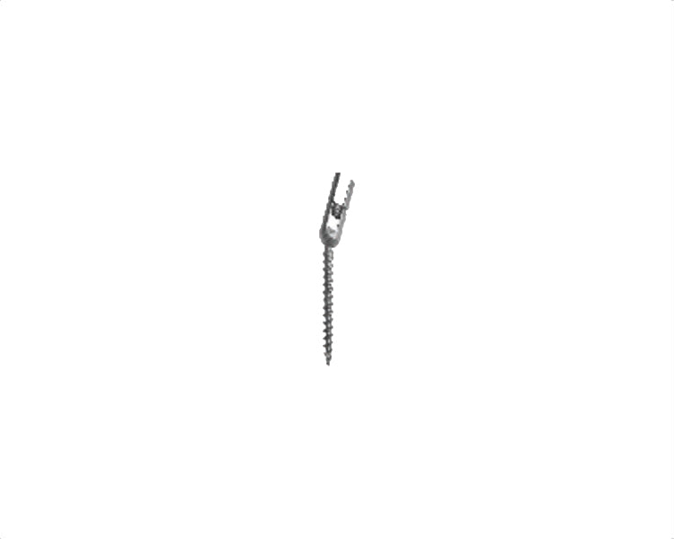 Polyaxial Reduction Screw - Titanium