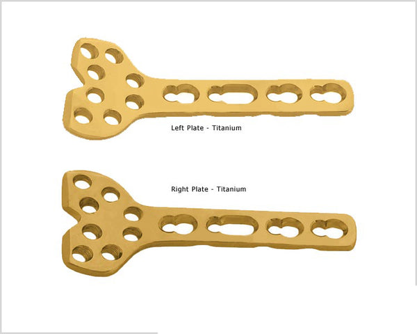 Volar Column Distal Radius Safety Lock Plate 2.4 (8 Head Holes)