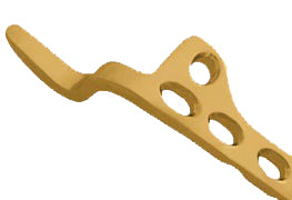 Clavicle Hook Plate 3.5