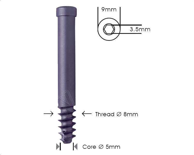 Locking Bolt Ø 8mm Cannulated Self Tapping For Pfn & Recon Nails Hlavní obrázek produktu